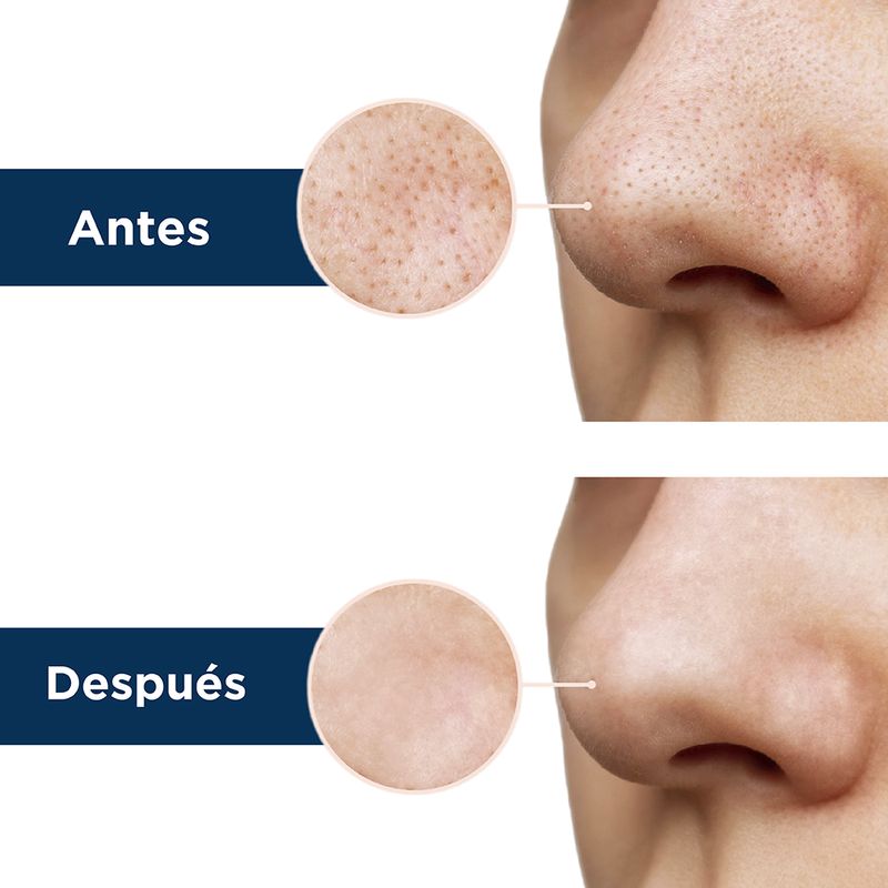Banda-de-puntos-negros-para-nariz-de-rbol-de-t-10pzas-Miniso-5-4280